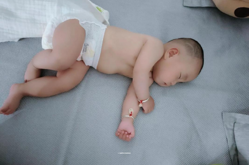 迪庆六个月宝宝眼睛散光